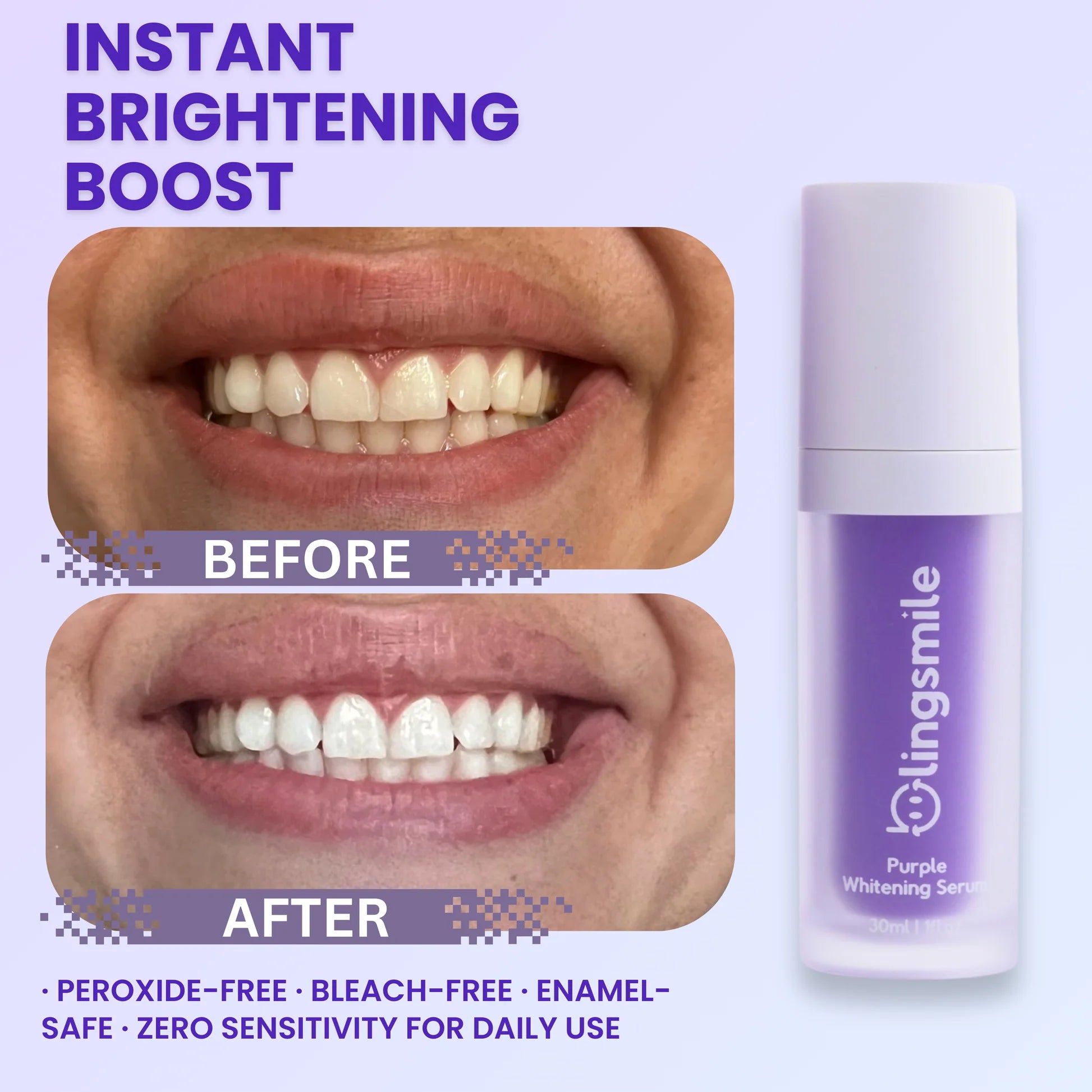 Hismile - Teeth Brightening Serum V34 (Original)