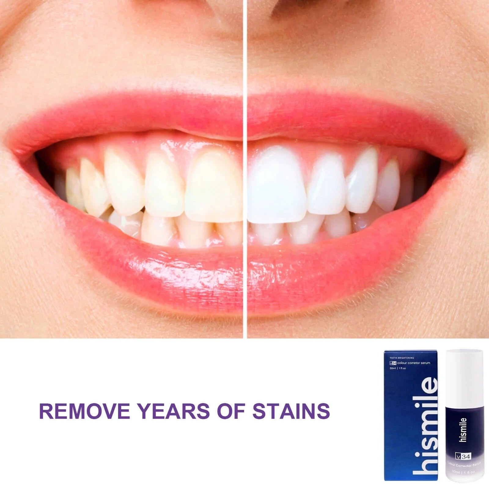 Hismile - Teeth Brightening Serum V34 (Original)